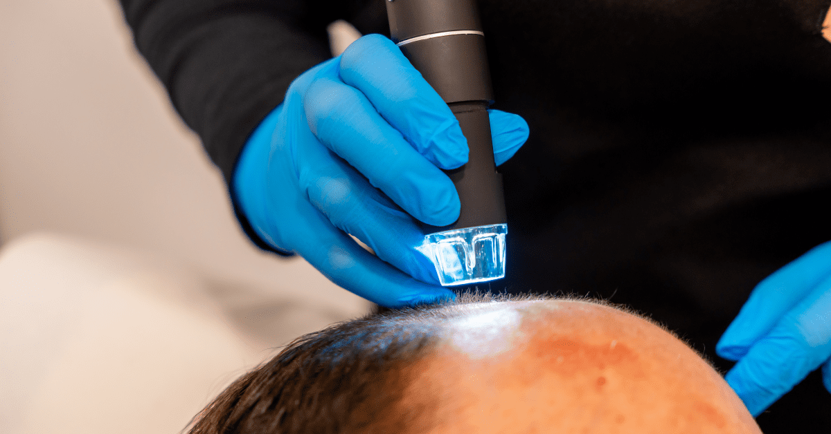 Lamprobe machine used for hair loss treatment at CliniSculpt Aesthetics, Kyalami